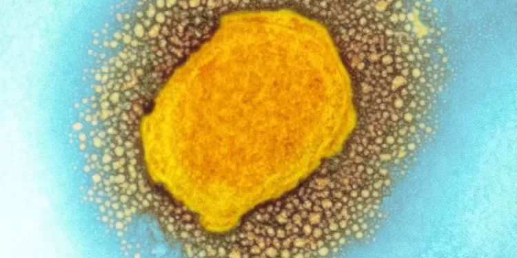 Foto: SCIENCE PHOTO LIBRARY