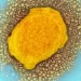 Foto: SCIENCE PHOTO LIBRARY
